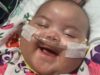 After Three Open Heart Surgeries, Baby Amilia Continues to Fight